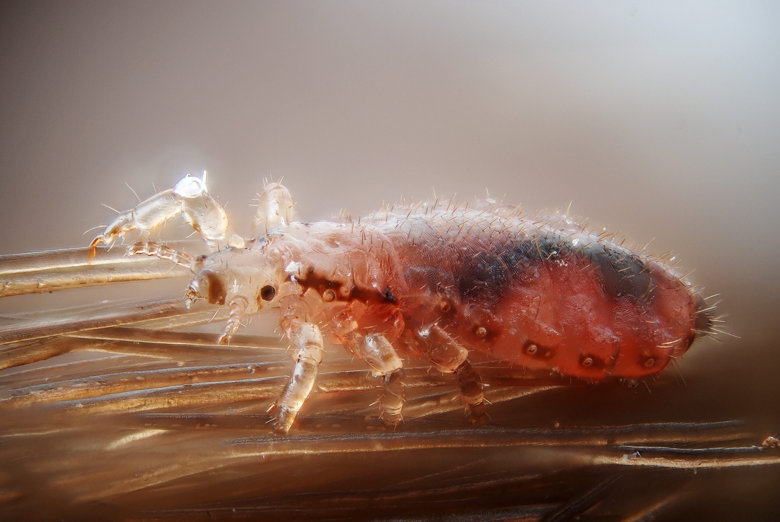 Why To Consider Using Natural Home Remedies To Kill Lice?