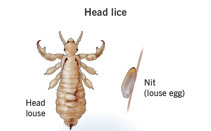 How To Check For Lice On Yourself?