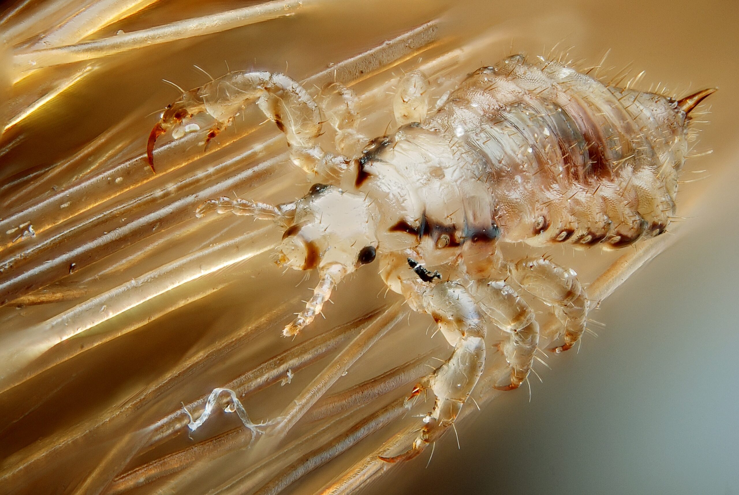 What Are Tips To Check For Lice On Yourself?